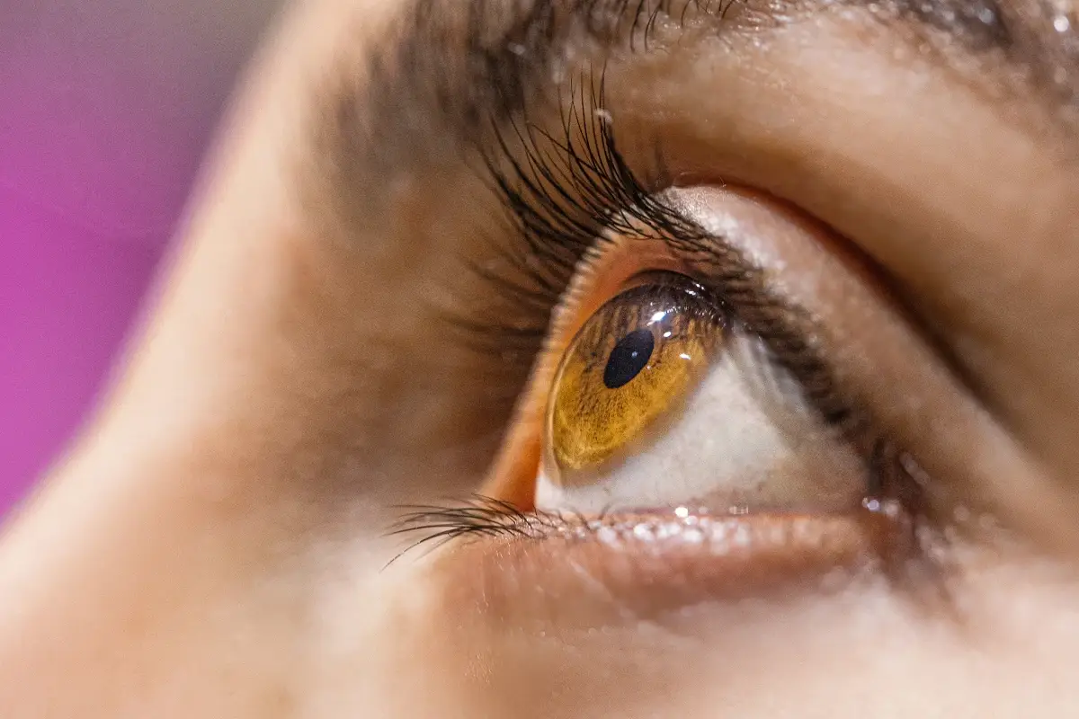 &Egrave; normale avere occhi di colore diverso?