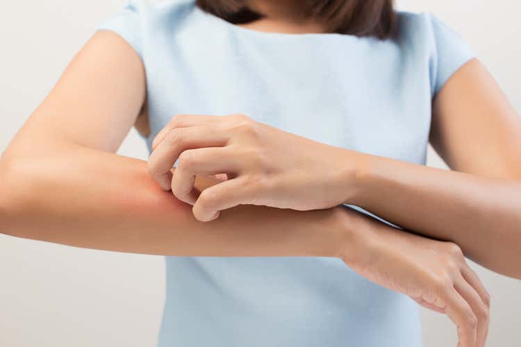 Allarme rinite e orticaria in tutta Italia Allarme rinite e orticaria in tutta Italia