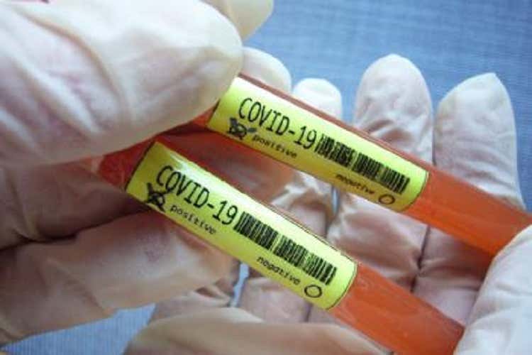 Coronavirus, analisi su 355 morti: solo lo 0,8% senza patologie