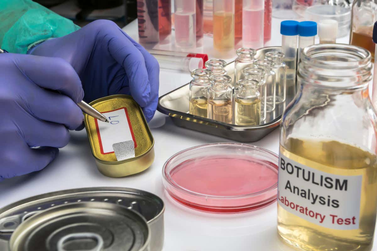 Tra il 2001 e il 2024 sono stati segnalati oltre 1.276 casi sospetti di botulismo