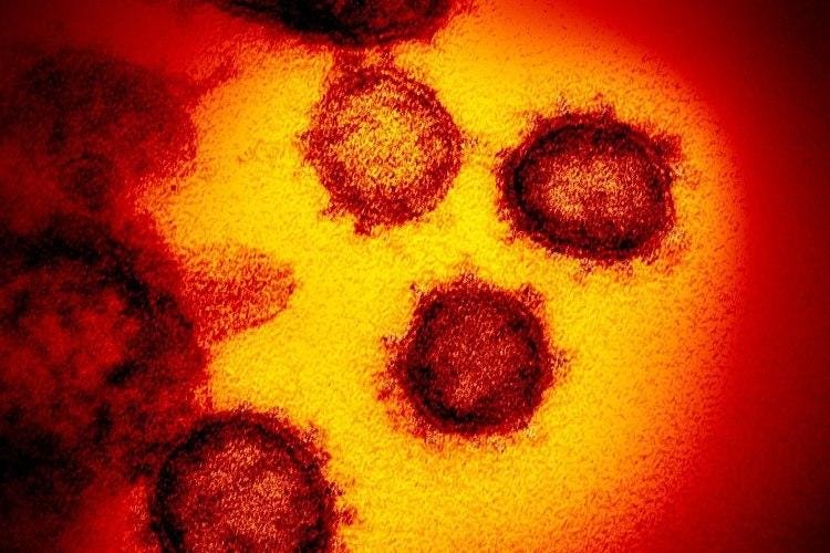 Coronavirus - Quanto sono preparati gli Stati Uniti a gestire l'emergenza coronavirus ?