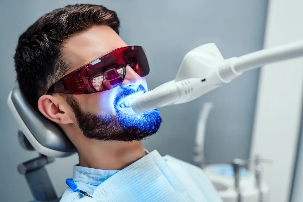 Sbiancamento dentale: ecco a cosa serve