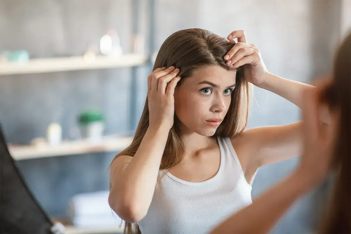 La dermatite seborroica coinvolge il cuoio capelluto ma pu&ograve; espandersi anche ad altre zone del corpo, come il petto