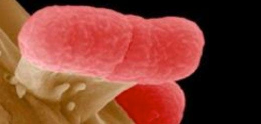 Conoscere il batterio E.coli per evitare il contagio