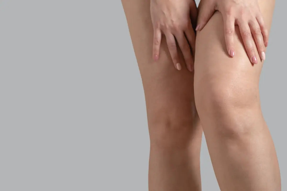 Gambe gonfie: camminare pu&ograve; essere d'aiuto