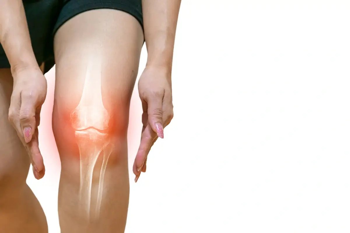 Un infortunio piuttosto comune, ma molto complicato e doloroso Rottura dei legamenti del ginocchio: come ritornare a fare sport?