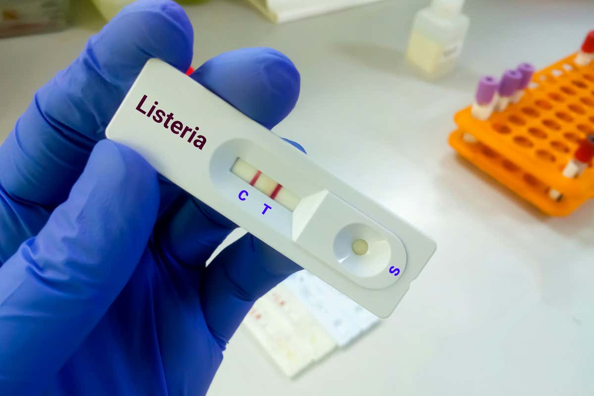 Un'ottantenne è deceduto per meningite da Listeria Listeria nei Wurstel, muore ottantenne di Alessandria