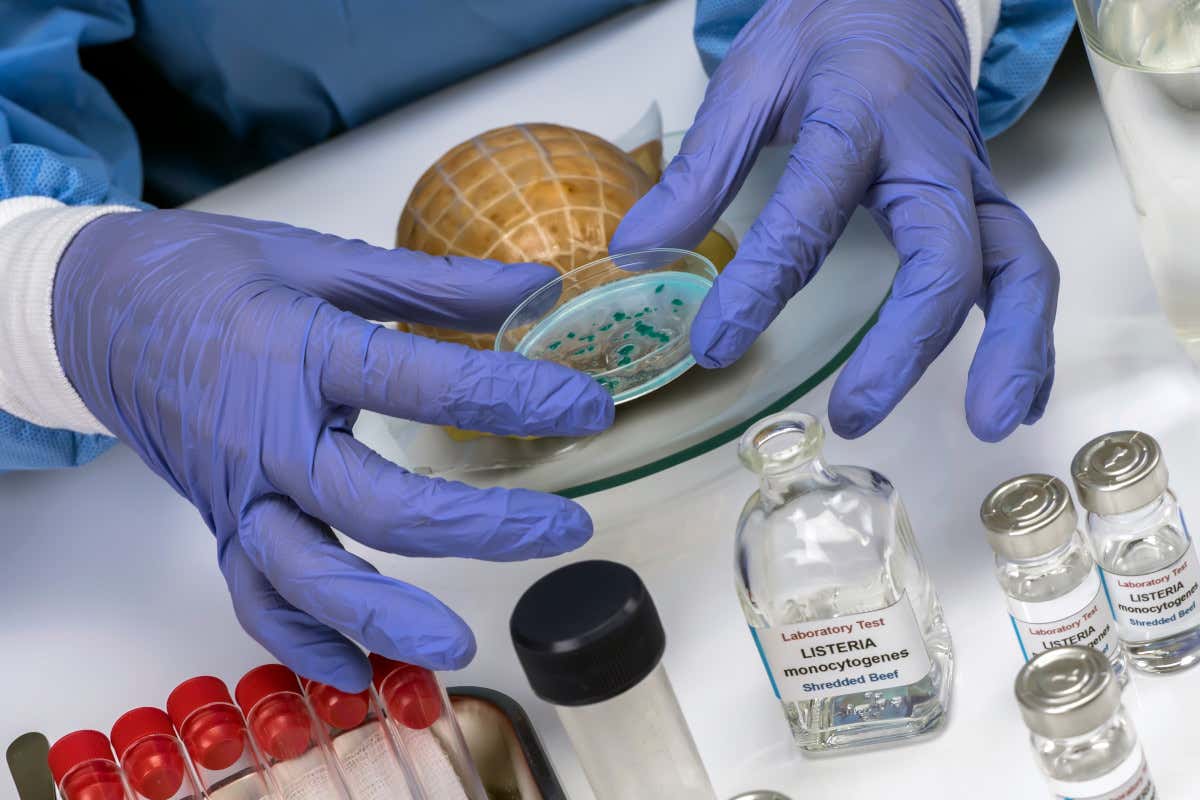 La Listeria monocytogenes è un batterio insidioso perché si moltiplica anche a basse temperature