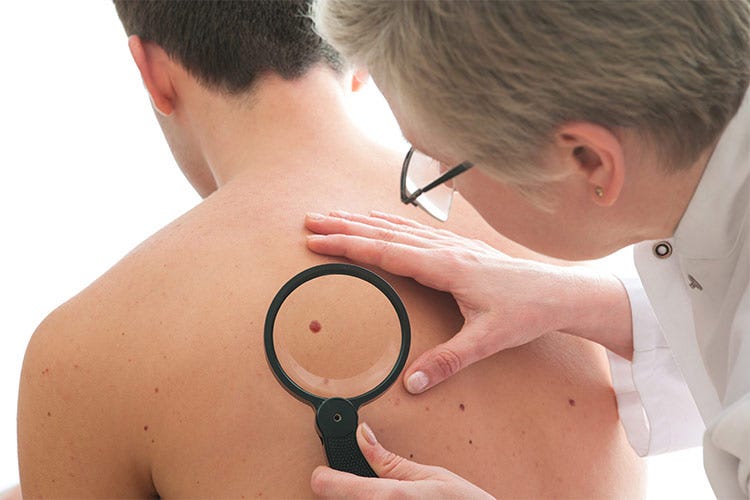 Visite a cadenza regolare dal dermatologo per la mappatura dei nei: la miglior prevenzione al melanoma
