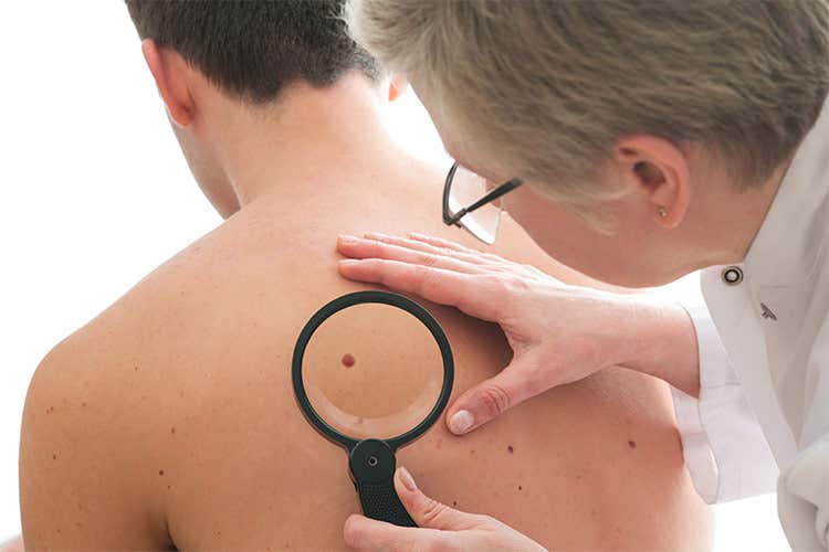 Visite a cadenza regolare dal dermatologo per la mappatura dei nei: la miglior prevenzione al melanoma Visite a cadenza regolare dal dermatologo per la mappatura dei nei: la miglior prevenzione al melanoma
