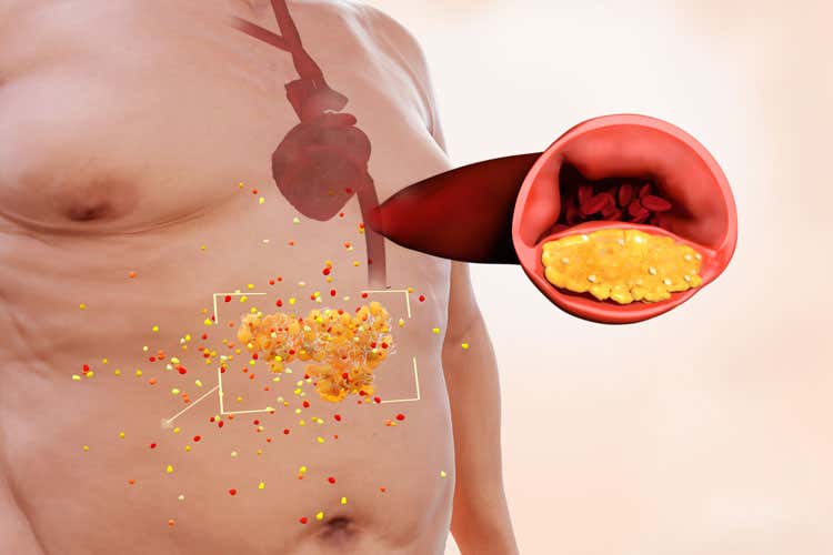 (Obesit&agrave; e malattie oncologiche Una relazione provata dalla scienza)