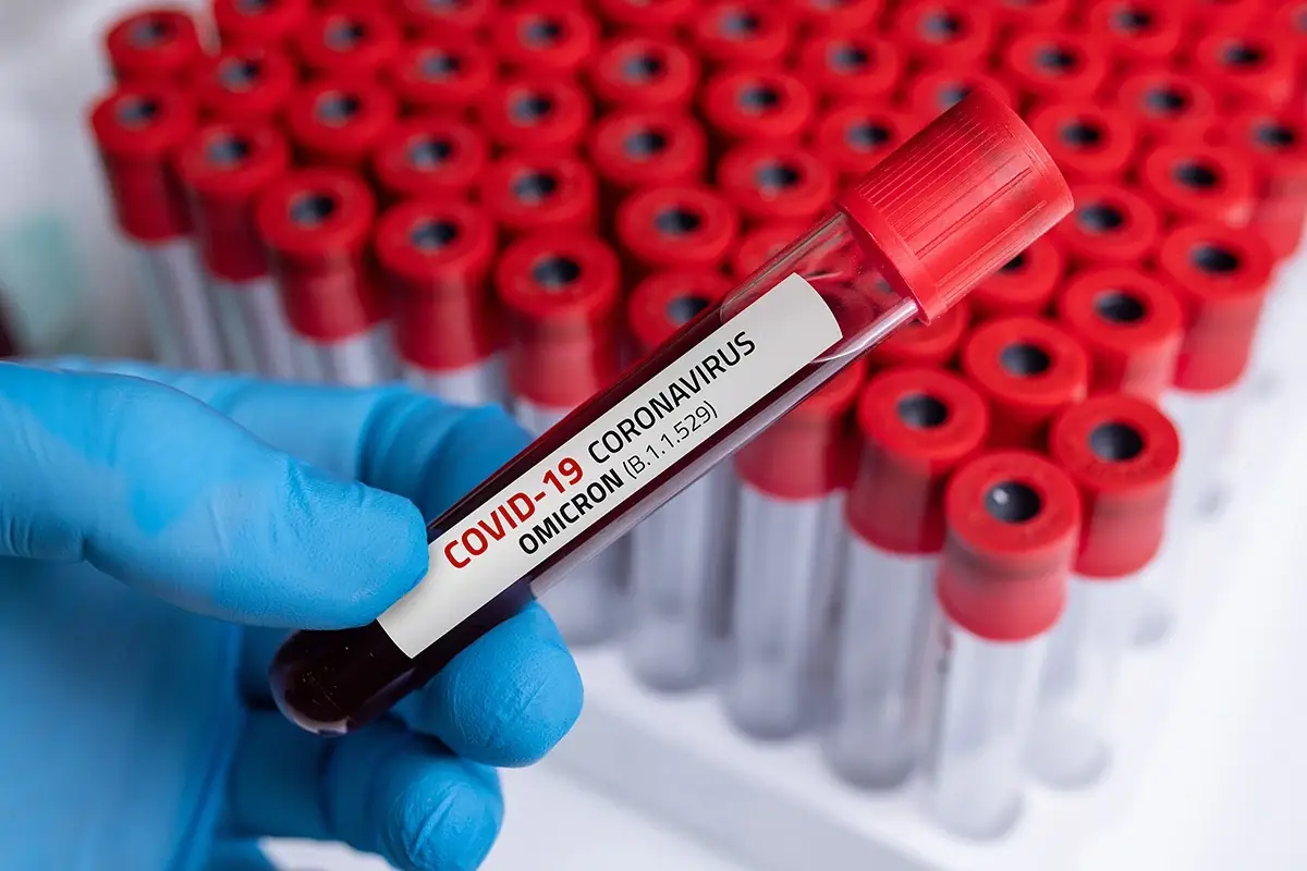 &Egrave; il virus pi&ugrave; esplosivo e quello con la diffusione pi&ugrave; rapida della storia Infettivologo, Omicron batte il morbillo: virus pi&ugrave; contagioso della storia