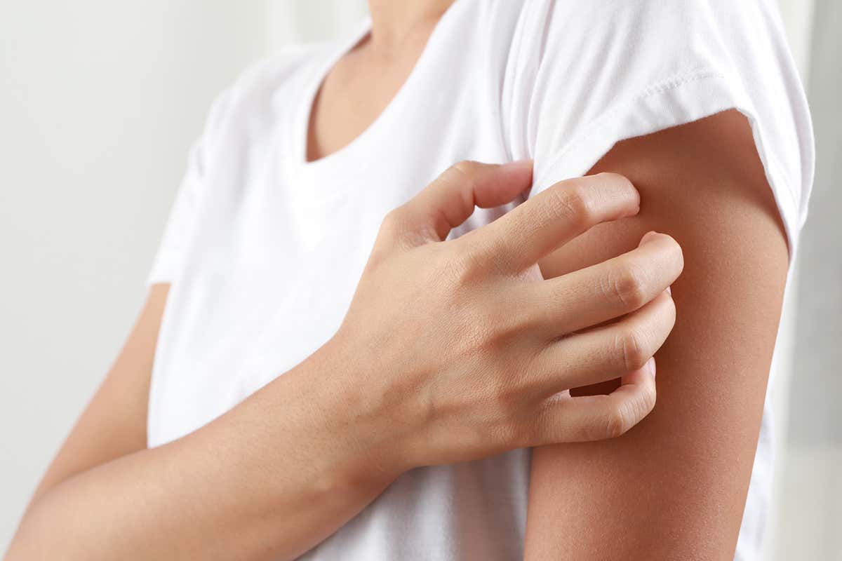 Quali sono i sintomi dell'orticaria? Orticaria, quali sono i sintomi e come si cura Quali sono i sintomi dell'orticaria? Orticaria, quali sono i sintomi e come si cura