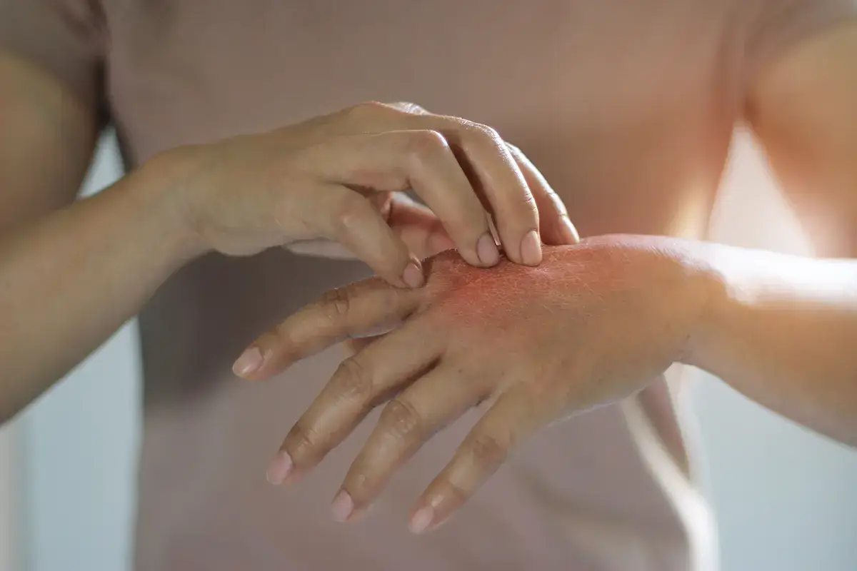Rimedi contro problemi stagionali Pelle secca? In inverno evitare docce bollenti