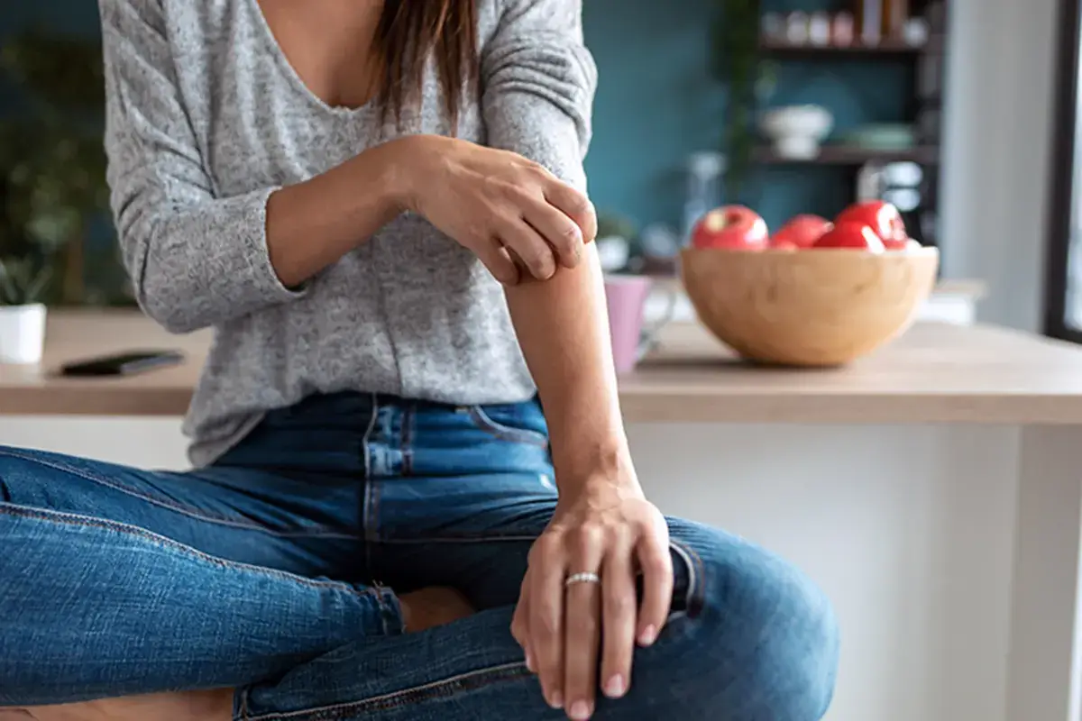 Psoriasi e cibo, quale relazione? La psoriasi si combatte a tavola