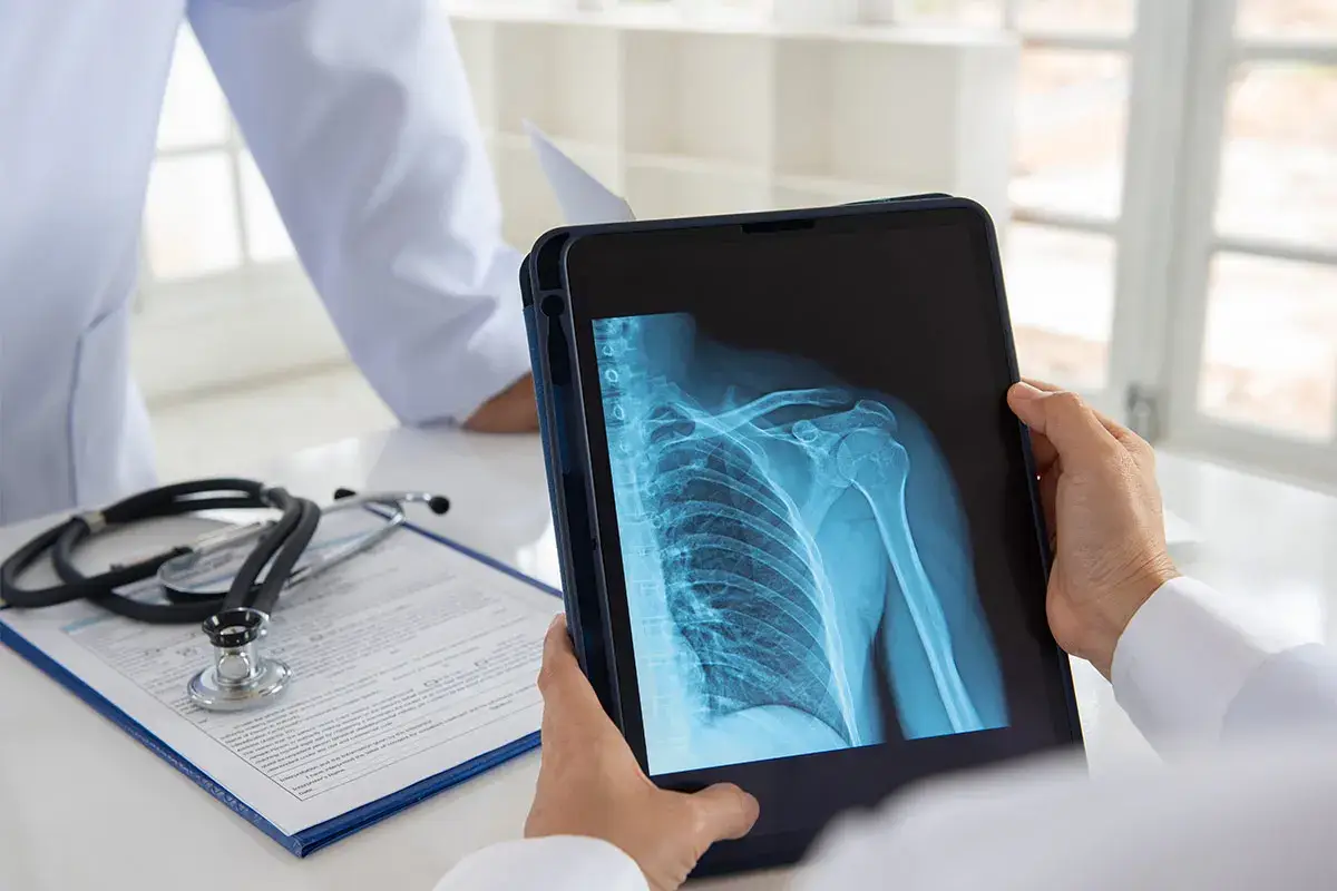 La sindrome da impingement &egrave; una patologia infiammatoria molto comune