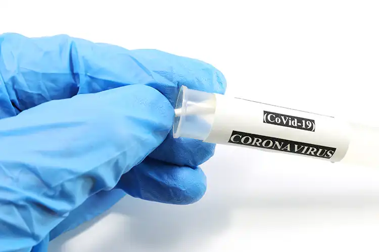 Il tasso di positivit&agrave; cala al 5,9% Ritmo spedito sulle vaccinazioni e tasso di positivit&agrave; in calo