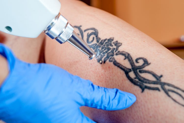 In Italia è tatuata una persona su 10 (Tatuaggi, test allergici per prevenire fastidi alla pelle)