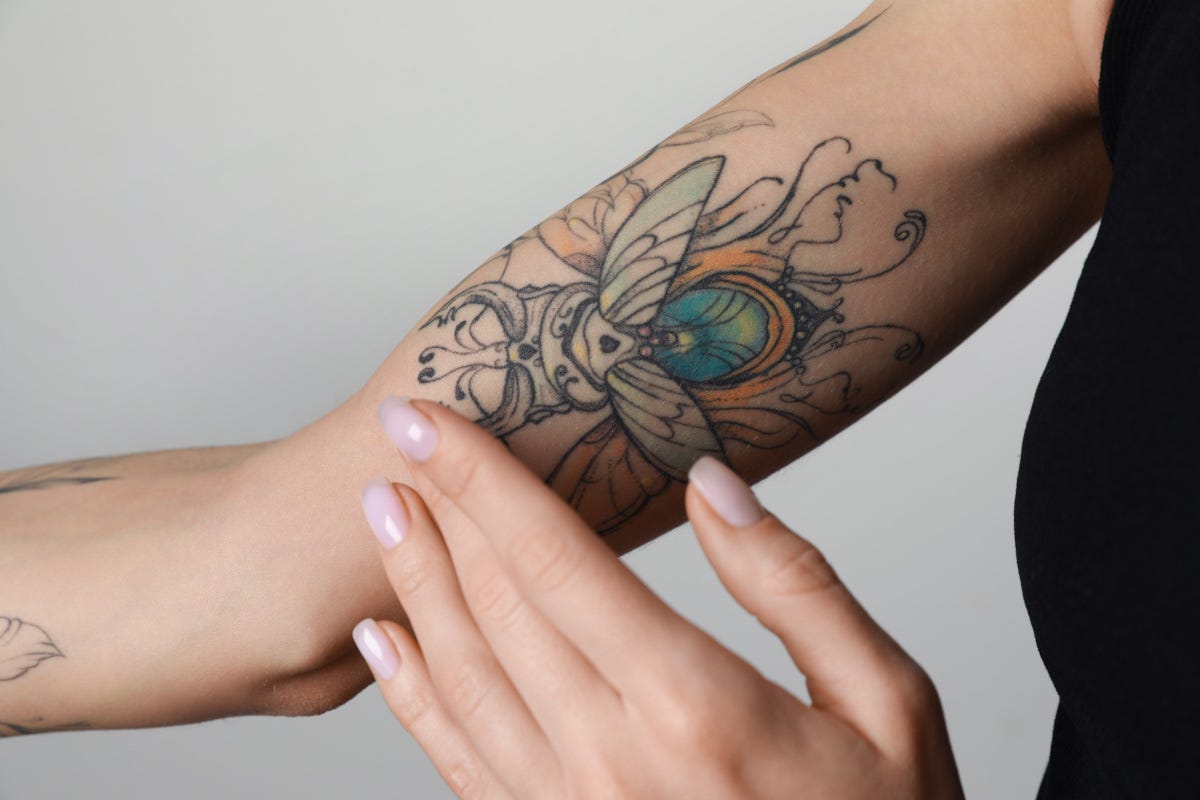 Come si rimuove un tatuaggio?