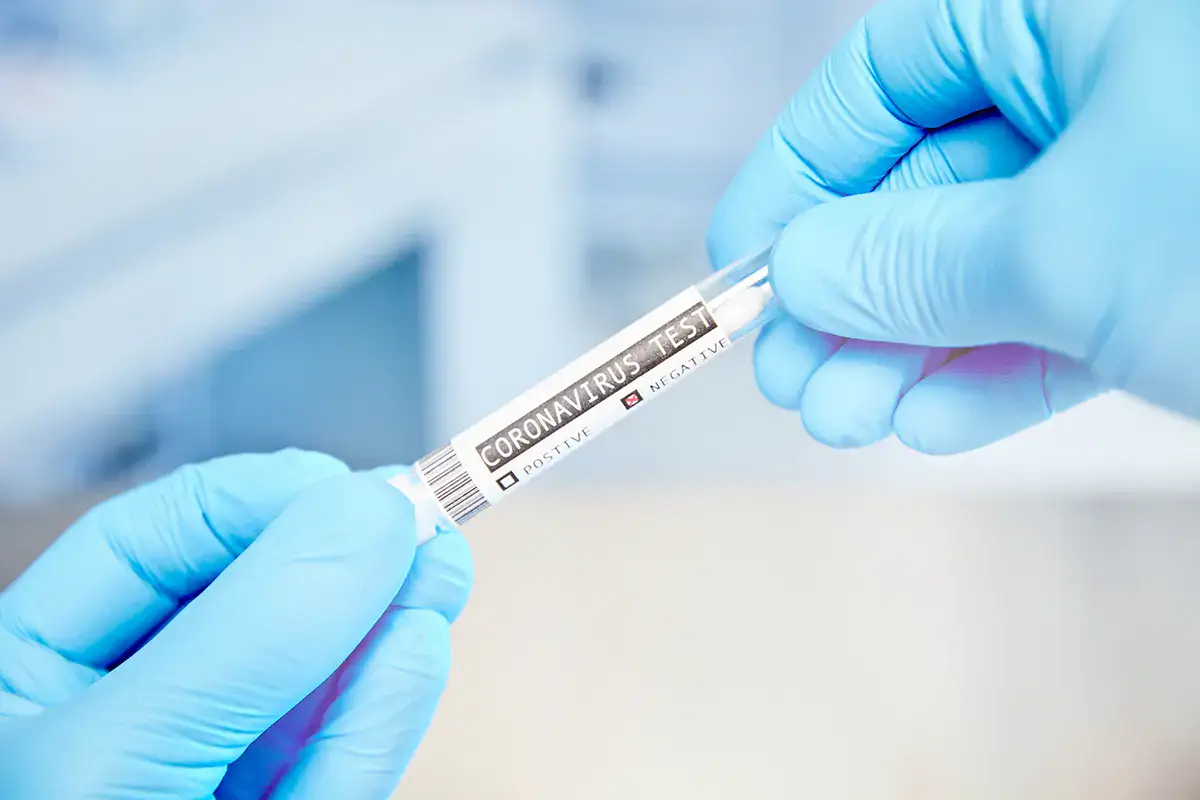 Per entrare in Italia &egrave; obbligatorio sottoporsi a un test anti-Covid fino al 31 gennaio Tampone obbligatorio per entrare in Italia, la risposta di Drgahi all'Europa