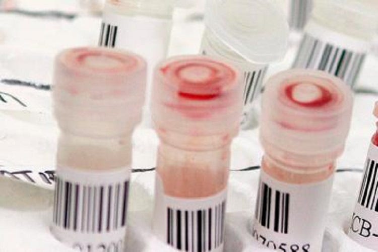 Fontana:«Trovato test sierologico affidabile per anticorpi»